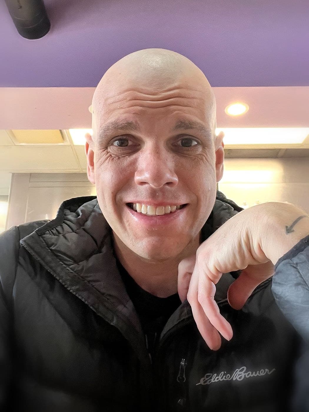 Pete during his cancer treatment, smiling